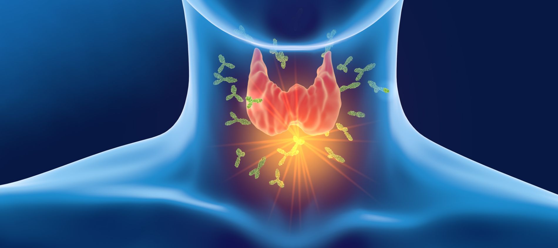 Autoimmunerkrankungen